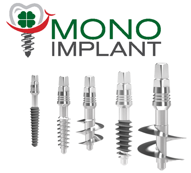 MONOIMPLANT-PICTURE2 (1)